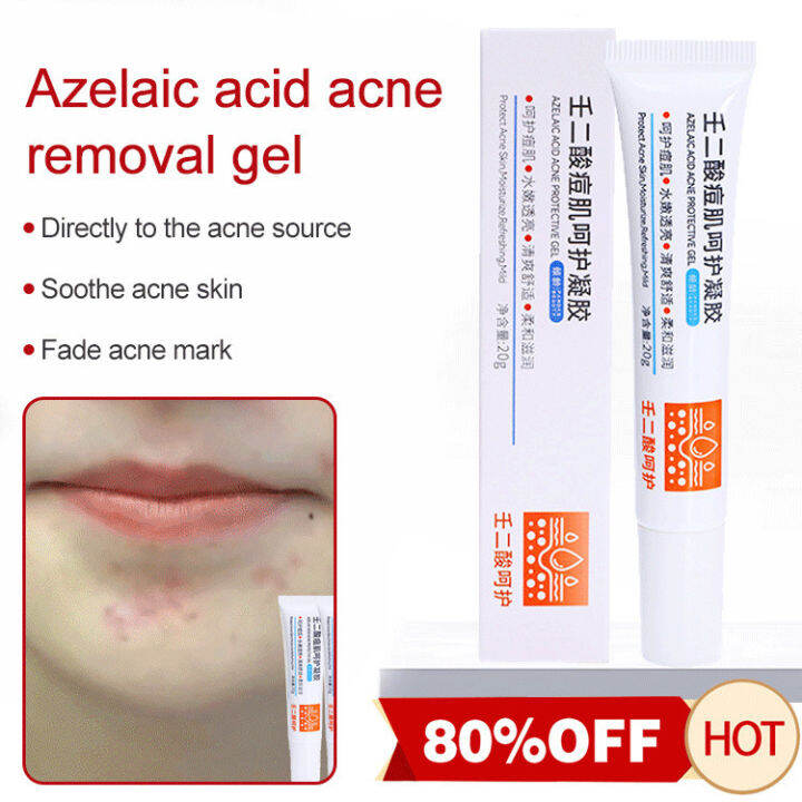 pici123 Niacinamide Rub Mud Cream exfoliates dead skin removes chicken