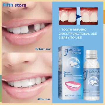 Resin False Teeth Temporary Tooth Repair Set Moldable Teeth&Gap False Teeth