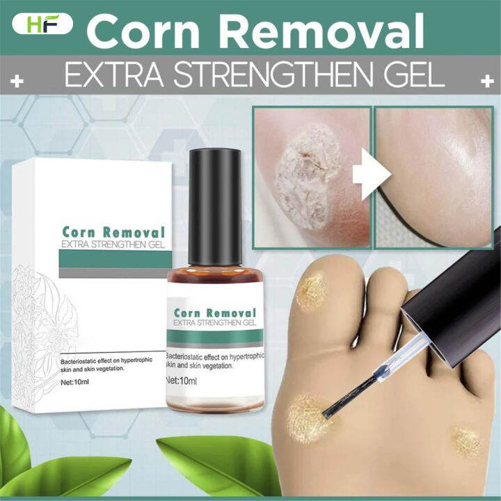 Corn Removal Extra Strengthen Gel 10ml Body Warts Cream Foot Care Cream