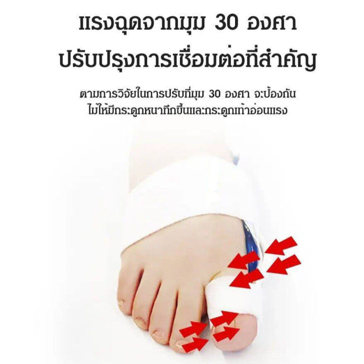 นำเข้าจากประเทศเยอรมนี-อุปกรณ์ดัดนิ้วเท้า-อุปกรณ์แก้ไขเท้าผิดรูป-ซิลิโคนคั่นนิ้วเท้า-อุปกรณ์คั่นนิ้วเท้า-อุปกรณ์แก้ไขเท้า-นิ้วโป้งโค้งงอเข้