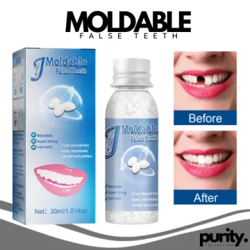 30ML Temporary Tooth Repair Kit Filling Teeth Gaps Moldable False