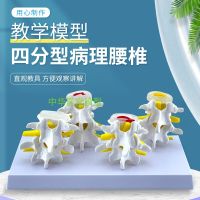 Normal medical lumbar spine bone lesions and combination model of lumbar spine orthopaedic teaching model of human body bone pathology