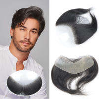 0.06มิลลิเมตรอัลตร้าผิวบางผู้ชาย Toupee สำหรับหน้าผาก V รูปร่างหน้าผากเส้นผมแพทช์สำหรับชายมนุษย์ผมวิกผมเส้นเลือดฝอยเทียม Peruk ~