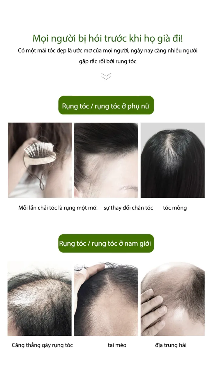Thủ phạm gây rụng tóc bất thường và cách lấy lại mái tóc dày mượt bồng  bềnh