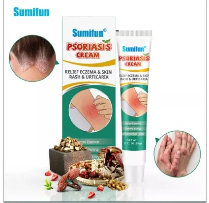 psoriasis cream (green tube)-30 | Lazada PH