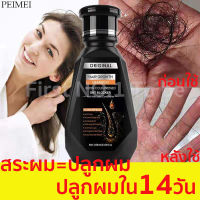 จัดส่งทันที แชมพูสูตรขิงสด 250ml  เร่งผมเกิดใหม่  แชมพูขิงเพียว  แชมพูแก้ผมร่วง  แชมพูเร่งผมเกิดใหม่  น้ำยาสระผมแก้ผมร่วง  ทำให้รากผมแข็งแรงขึ้น  กำจัดรังแค  ป้องกันผมร่วง  Hair loss shampoo แชมพูสมุนไพร   แชมพูแก้ปัญหาผมร่วง  แชมพูลดผมร่วง