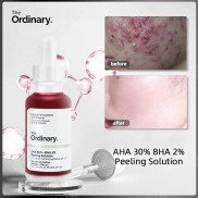 serum the ordinary AHA 30% + BHA 2% serum tẩy tế bào chết da mặt chính hãng