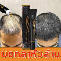 (ผู้ขายในท้องถิ่น) โรลออน น้ำยาปลูกผม น้ำมันปลูกผม เซรั่มปลูกผม ประกอบด้วยสารสกัดจากสมุนไพรนานาชนิด ช่วยบำรุงผมให้ยาวเร็ว ลดผมร่วง บอกลาหัวล้าน（น้ำยาใส่ผม น้ำยาเร่งผมยาว สเปรย์ปลูกผม น้ำยาปลูกคิ้ว สเปรย์ผมยาวไว นํ้ายาเร่งผมยาว สเปรย์ปลูกผม เซรั่มปลูกผมดก）