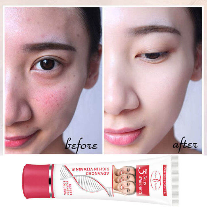 Skin care products moisturizer whitening cream Face Bleaching Cream