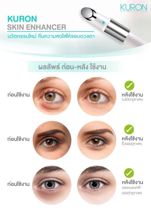 kuron-เครื่องนวด-รอบดวงตา-skin-enhancer