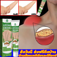 แท้OUHOE ออกแบบ36ชนิดของไขมันใต้ผิวหนังกำจัดมวลก้อนไปยังถุงน้ำ Lymph Care Ointment สมุนไพรกำจัด ก้อนเนื้อใต้ผิวหนัง ก้อนซีสต์ ก้อนไขมัน ครีมทาซีส ก้อนไขมัน ครีมระบายน้ำเหลือง ครีมน้ำเหลืองแบบอ่อนโยน ครีมบวมคอ ต่อมน้ำเหลืองบริเวณรักแร้ พร้อมส่งทั่ว