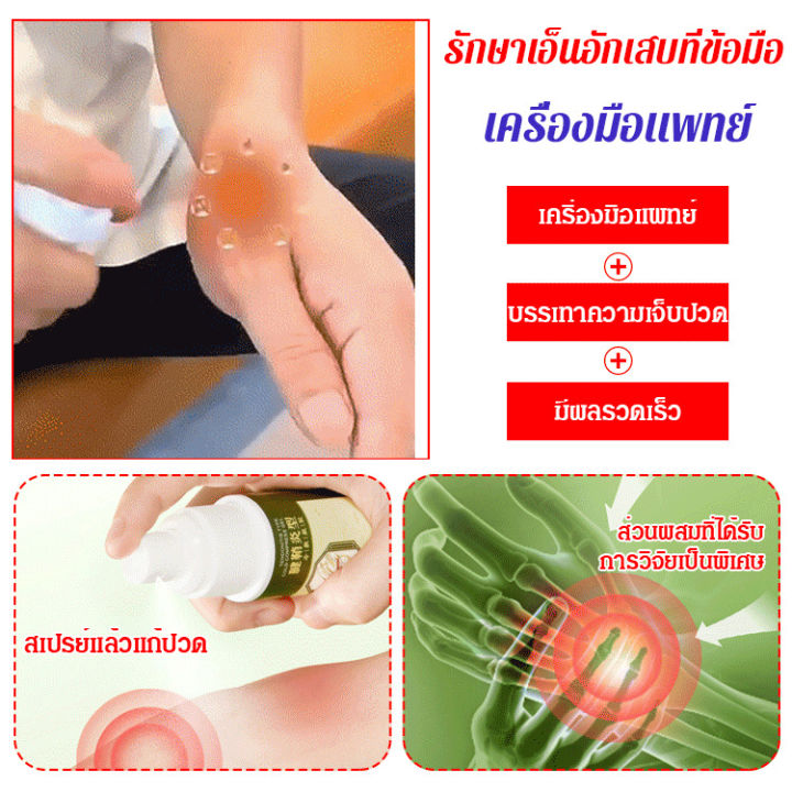 usmartt-สเปรย์แก้ปวดส้นเท้า-tenosynovitis