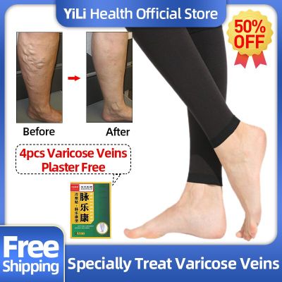 Varicose Veins Socks Vasculitis Phlebittis Spider Legs Treatment Medical Stockings Vein Stretch Compression 1 Pair Leg Care