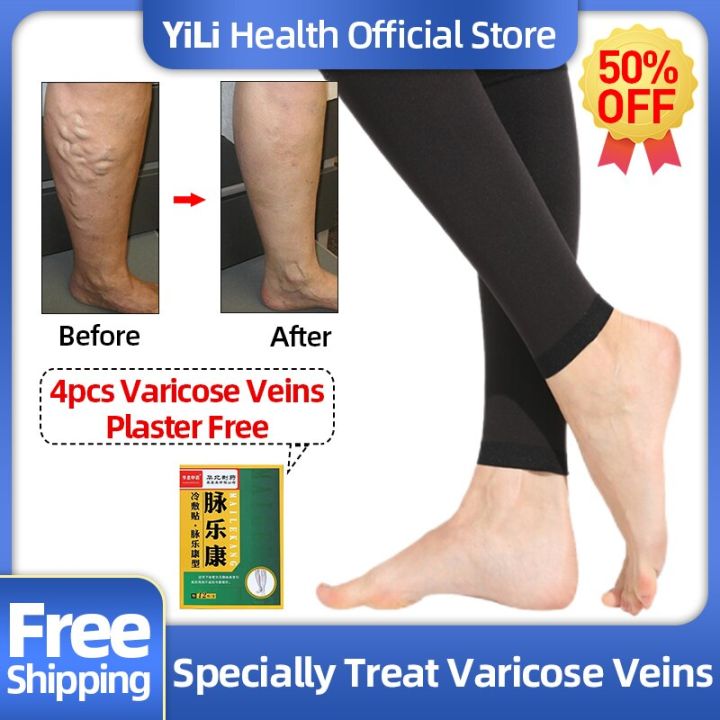 varicose-veins-socks-vasculitis-phlebittis-spider-legs-treatment-medical-stockings-vein-stretch-compression-1-pair-leg-care