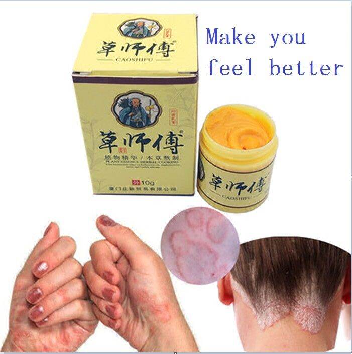 Caoshifu 50g Eczema Treatment Ointment Antibacterial Psoriasis Cream Herbal Itching Skin Care 8314