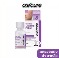 [กู้ผิวหลังสิวหาย!] Oxecure Dark Spot Clearing Potion 15ml แป้งน้ำม่วงลดเลือนรอยสิว จุดด่างดำ อ๊อกซีเคียว ดาร์คสปอต