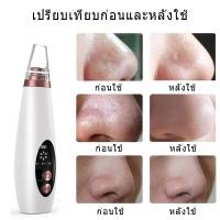 เครื่องดูดสิวเสี้ยนไฟฟ้า 1274