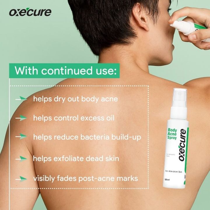 oxe-cure-body-acne-spray-สเปรย์ฉีดสิวหลังสเปรย์ฉีดสิวหลัง-25-ม-ล-50-ม-ล