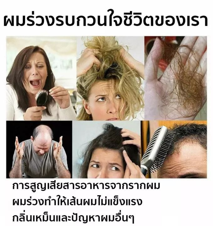 ดูแลหนังศีรษะ-meikieen-ยาสระผมเชื้อรา-ขจัดรังแค-หยุดอาการคัน-ลดผมร่วง-แชมพูขจัดรังแค-500ml-ยาสระผมรังแค-เชื้อราบนศีรษะ-ยาสระผมแก้เชื้อรา-ยาสระผม-แชมพู-แชมพูสระผม-ยาสระผมรังแค-แชมพูรังแค-แชมพูเชื้อรา-แ