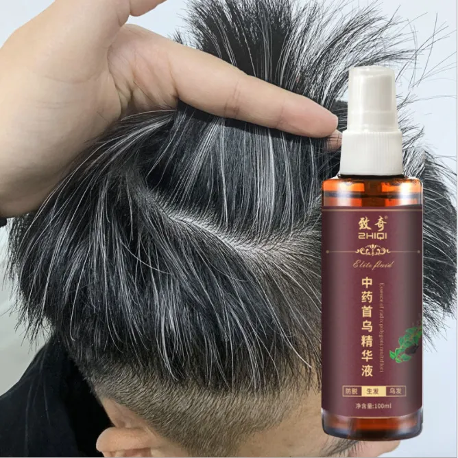 Natural Black Hair Gray hair blackening prevent hair loss spray 100ml hair colour hair tonic /Nourish/Dye Grey Hair White Hair Turn To Black Hair Treatment Plant Herbal Essence | Lazada Natural Black Hair Gray hair blackening prevent hair loss spray 100ml hair colour hair tonic /Nourish/Dye Grey Hair White Hair Turn To Black Hair Treatment Plant Herbal Essence | Lazada