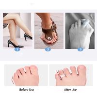 ✐☞◘ 1Pair of Toe Separators Straightener Gel Spreader Correct Crooked Toes Bunion Corrector and Bunion Relief Pads for Hallux Valgus