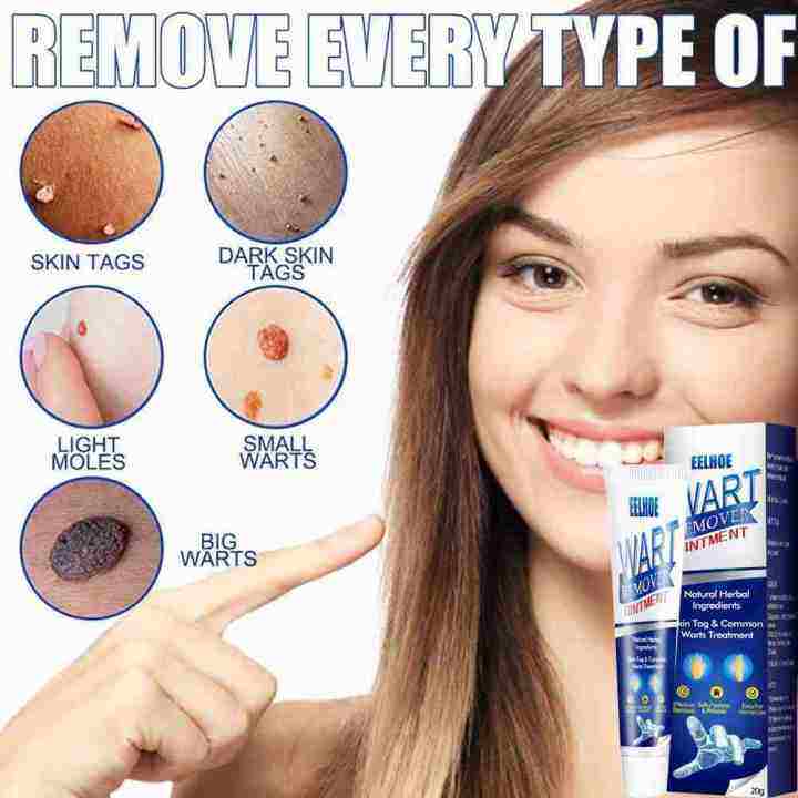 Warts Remover Cream Wart Removal Ointment Wart Skin Tags Remover Cream