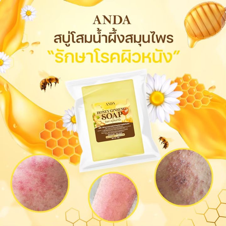 พร้อมส่ง-สบู่โสมน้ำผึ้ง-anda-โรคสะเก็ดเงิน-โรคผิวหนังคับ-กลากเกลื้อน-เชื้อรา-น้ำเหลืองเสีย-จบที่ก้อนเดียว-หายขาด