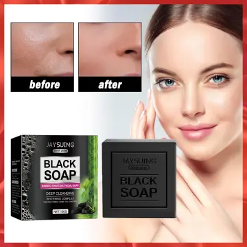 Best Skin Whitening Soap Best Price in Singapore Apr 2024