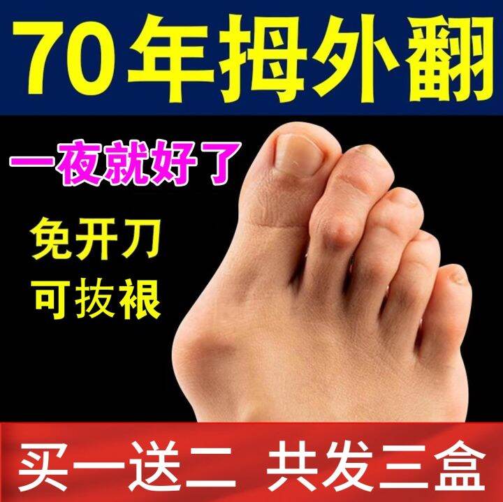 Toe Rectifier Thumb Valgus Paste Correction Split Toe Artifact Men And 