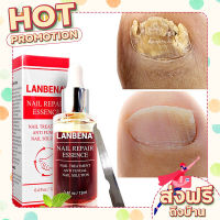 ส่งฟรี (เก็บเงินปลายทาง) LANBENA ซ่อมแซมเล็บ รักษาเชื้อราที่เล็บ 12 มล. ตรงปก ส่งจาก กรุงเทพ