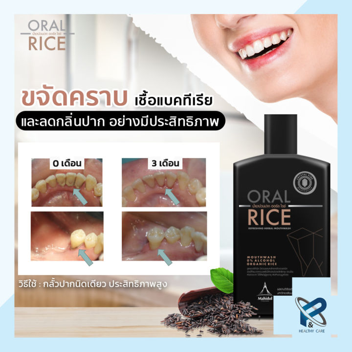 oral-rice-น้ำยาบ้วนปาก-สารสกัดธรรมชาติ-ข้าวสีดำ-ออแกนิค-สูตรเข้มข้น-ไม่มีแอลกอฮอลล์-โดยทันตแพทย์มหิดล