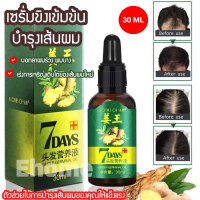 Ehomemall ขิงเซรั่มบำรุงผม ป้องกันผมร่วง 30ml แก้ปัญหาหัวล้าน เร่งผมงอกใหม่ ปรับปรุงคุณภาพของเส้นผม น้ำยาปลูกผม เซรั่มผม เซรั่มปลูกผม