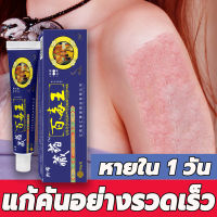 XIANGNIU ครีมแก้คัน 20g ทาคันเชื้อรา โรคผิวหนัง สารสกัดจากพืชใช้ได้ทั้งตัว เชื้อราผิวหนัง ได้ผล 100%