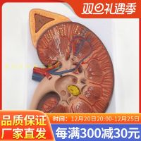 Renal anatomy of a 3 x magnification to heavy model anatomical model of kidney structure model of human renal model