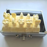 Dental Model Ental Cavity Preparation Model  #7009 01 Teeth Model