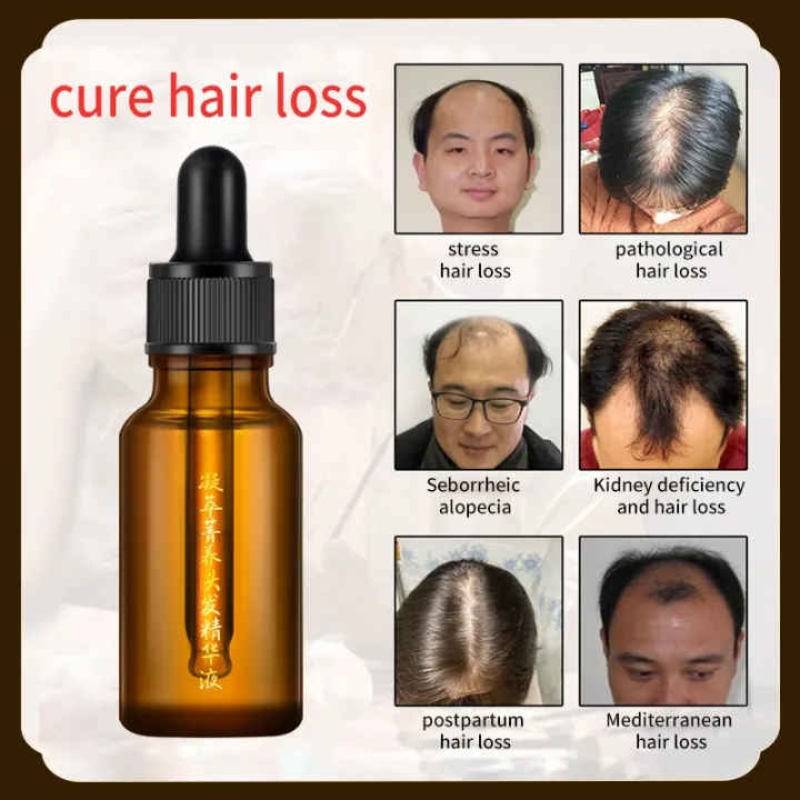 Hair Growth Serum Essential Oil Repair Damaged Nourishing Liquid 20ml Anti-dropping  hair growth agent Anti-Hair Loss Serum men and women Prevents Hair Loss |  Lazada Singapore