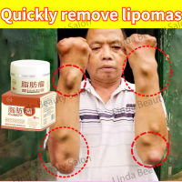 100% Original Lipoma Removal Cream Special Gel to Remove Multiple Single Lipoma Subcutaneous Lipoma Mass Lipoma Cream