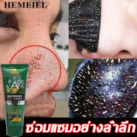 HEMEIEL  ทำความสะอาดรูขุมขน/ครีมลอกเสี้ยน/7วันเห็นผล/ กำจัดสิวเสี้ยน/มาร์คสิวเสี้ยน