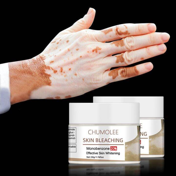 Chumolee Dark Knuckles Remover Eraser Monobenzone Whitening Cream