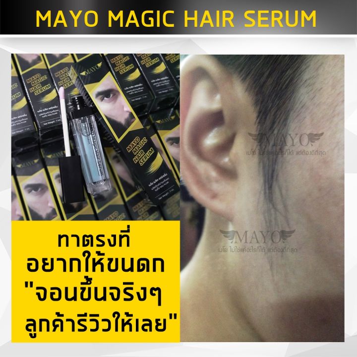 ส่งฟรี-ไม่ต้องใส่โค้ด-ส่งเร็วมาก-เมโย-เซรั่ม-ปลูก-คิ้ว-หนวด-จอน-เครา-ไรผม-mayo-ทาทุกวัน-หยุดใช้ไม่หลุดร่วง