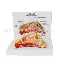 Supply female breast section pathological breast anatomical model of medical teaching model organs