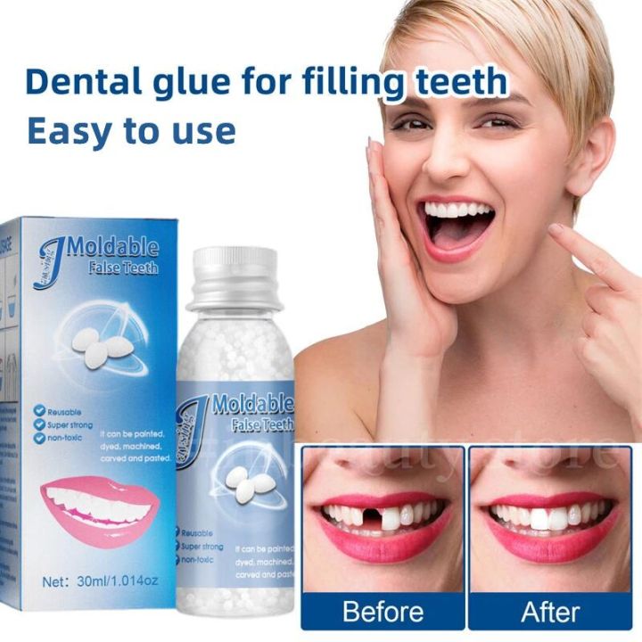 30g resin false teeth that fit