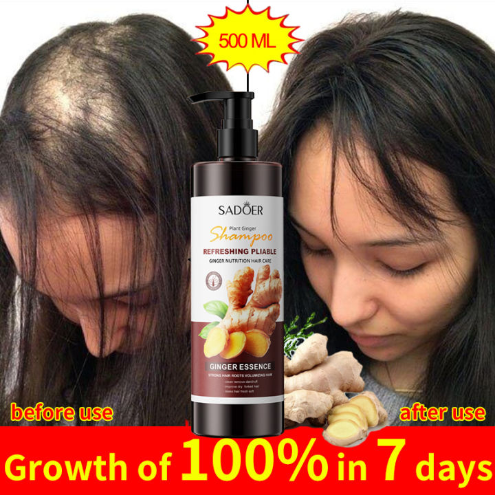 Shampoo ginger shampoo anti-hair loss scalp anti-dandruff anti-dandruff ...