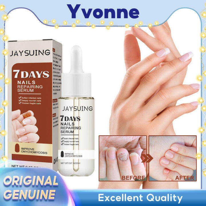 JAYSUING Nails Repairing Serum AntiFungal AntiInfective Herb Toe