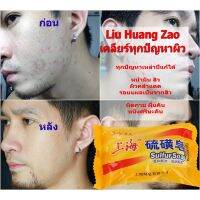 Clear skin Acne soap 85กรัม สบู่ขิงกรัมมาถัน เคลียร์ทุกปัญหาผิวหน้า และร่างกาย รับประกัน เห็นผลตั้งแต่ก้อนแรก