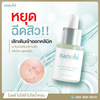 ✅นาโนบิ✅ nanobi เซรั่ม รักษาสิว จากญี่ปุ่น สารสกัดวาซาบิ ธรรมชาติ ผิวหน้า ไม่แพ้ สิวหาย ไม่เกิดซ้ำ