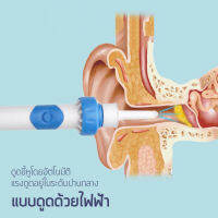 Romyse เครื่องดูดขี้หูไฟฟ้า อุปกรณ์ทำความสะอาดหูเกลียวที่ปลอดภัยและไม่เจ็บ