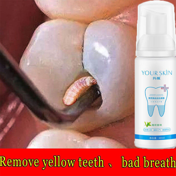 Teeth Whitening Mousse Toothpaste Oral Hygiene Remove Stains Plaque