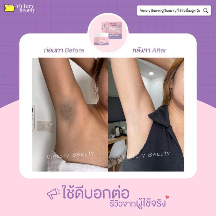 ครีมรักแร้ออนนี่-by-แม่แพท-onny-white-cream-ระงับกลิ่นกาย-5กรัม