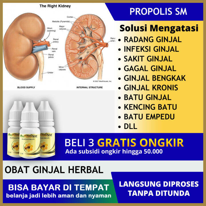 Obat Ginjal Bocor Ginjal Polikistik Ginjal Akut And Kronis